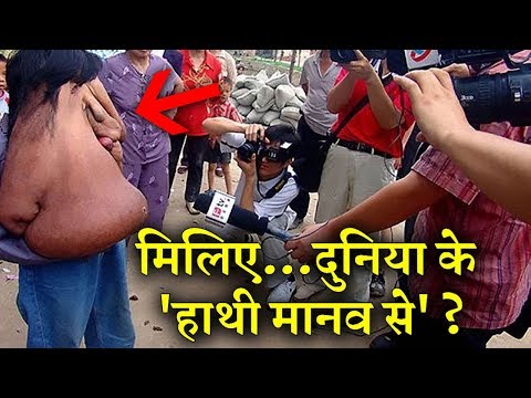 lalquilapost-hathi manav