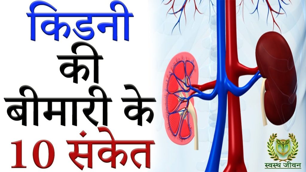 lalquilapost-kidney prob
