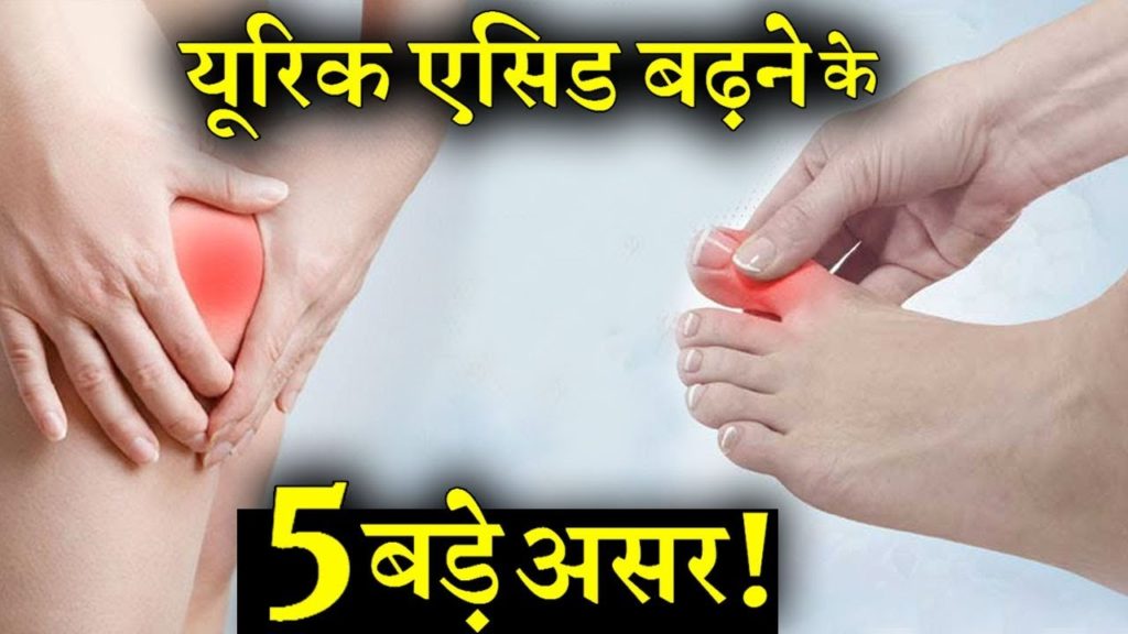 lalquilapost-uric acid