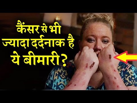 lalquilapost-durdnak bihari