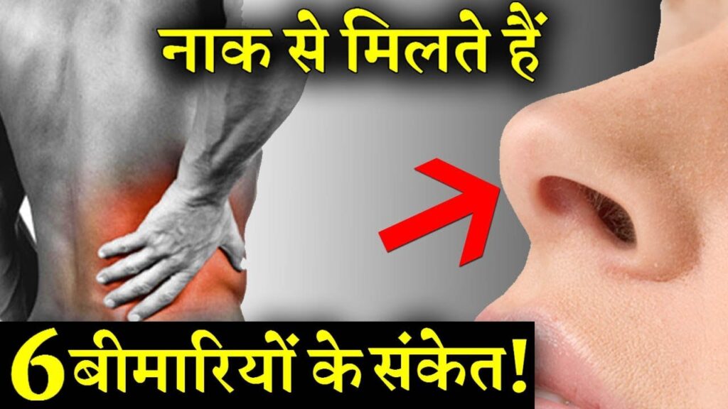 lalquilapost-nak say miltey bimari k sanket